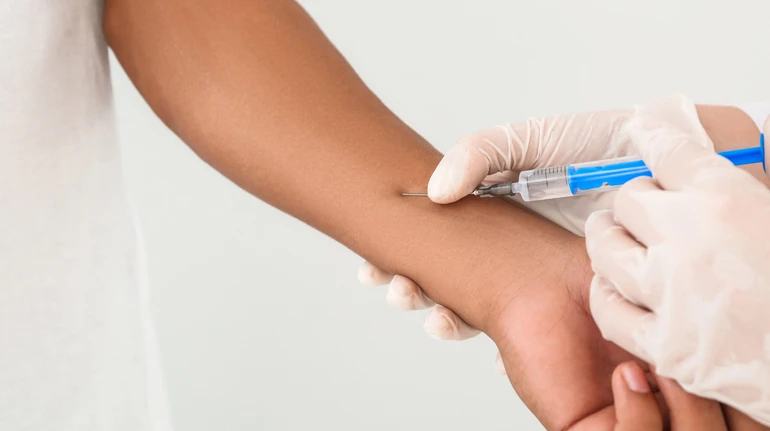 Без проби Манту: з квітня Україна почне переходити на нові методи діагностики туберкульозу