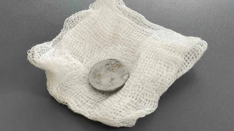 У Львові врятували 2-річну дитину, яка три місяці жила з батарейкою у стравоході