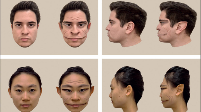Scientists recreated distorted faces seen by a patient with a neurological disorder