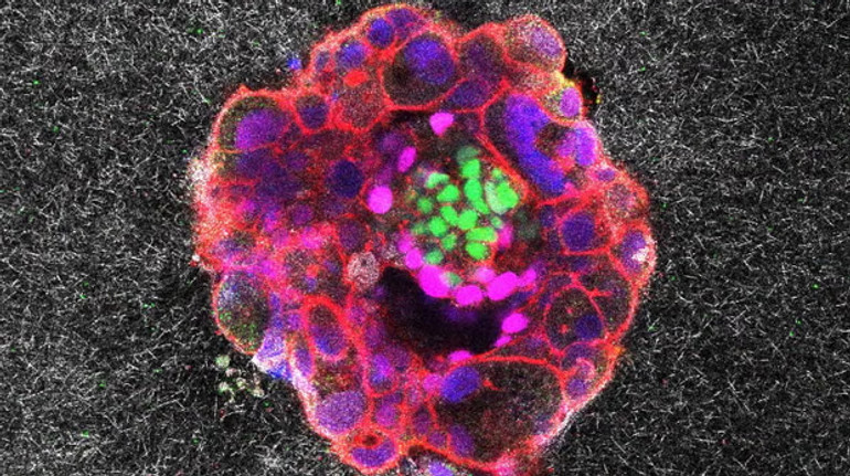 Напрочуд інвазивний процес: вчені вперше показали, як людський ембріон імплантується в матку