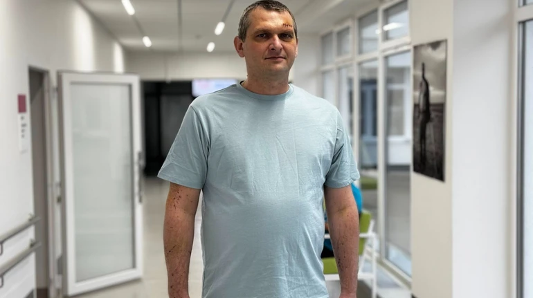 Дістали з грудей 10-сантиметровий уламок скла: у Львові врятували постраждалого через атаку Шахедів