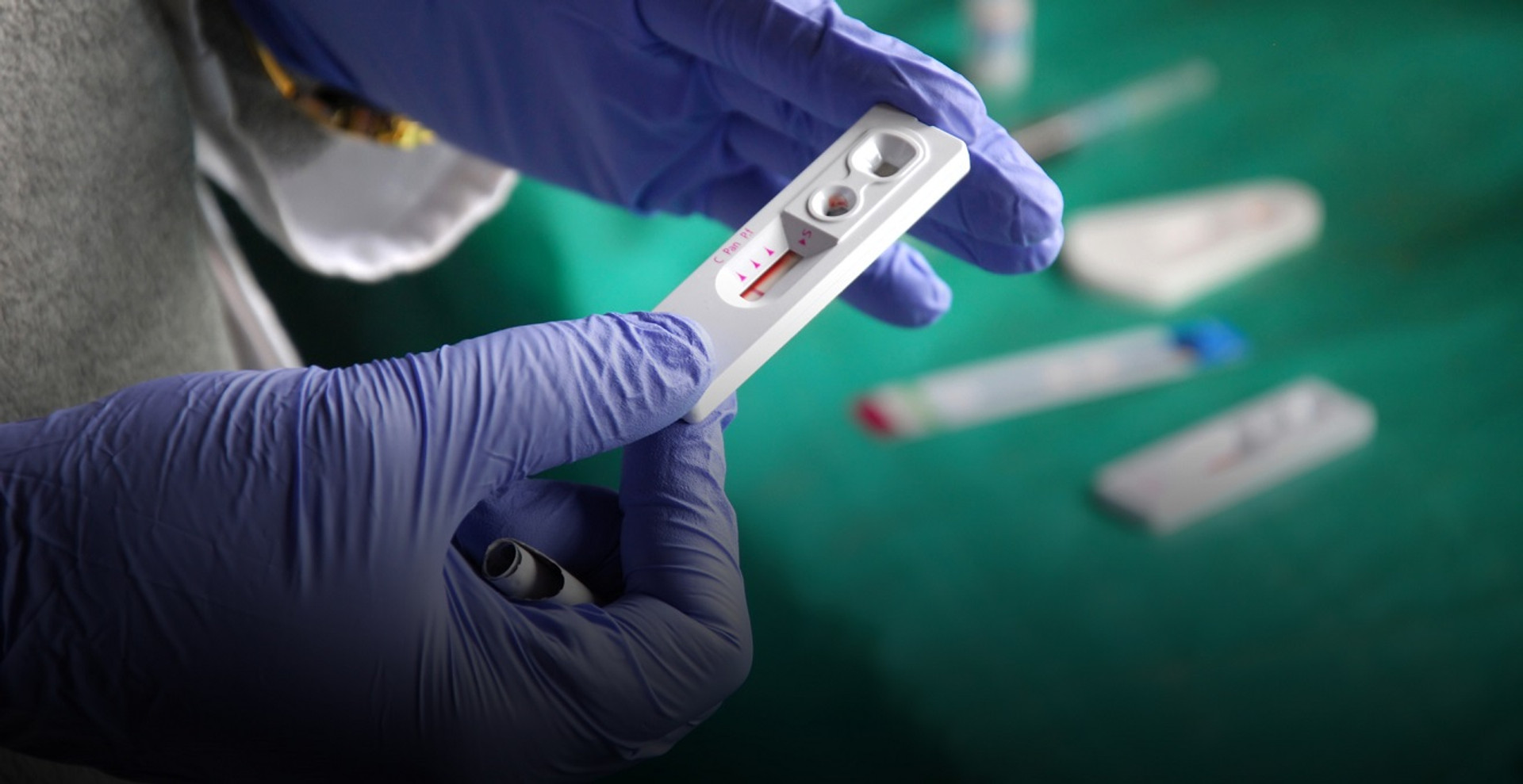 Мы остановим эпидемию.... Репортаж из пункта тестирования на ВИЧ