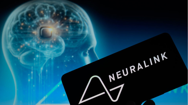 Маск: Перший пацієнт з чипом Neuralink може подумки керувати комп'ютерною мишею