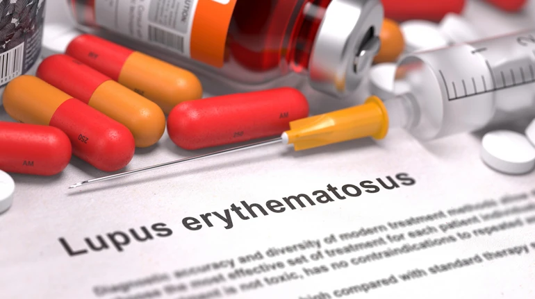FDA прискорило схвалення препарату для лікування системного червоного вовчака у дорослих