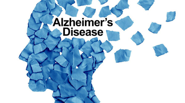 Чи може препарат від діабету лікувати хворобу Альцгеймера? Перші результати досліджень