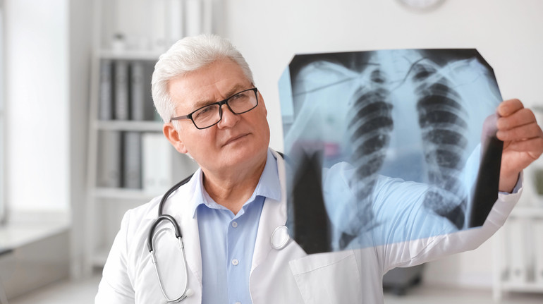 Чому люди з ВІЛ мають вищий ризик захворіти на туберкульоз і як від нього вберегтися: пояснення ЦГЗ