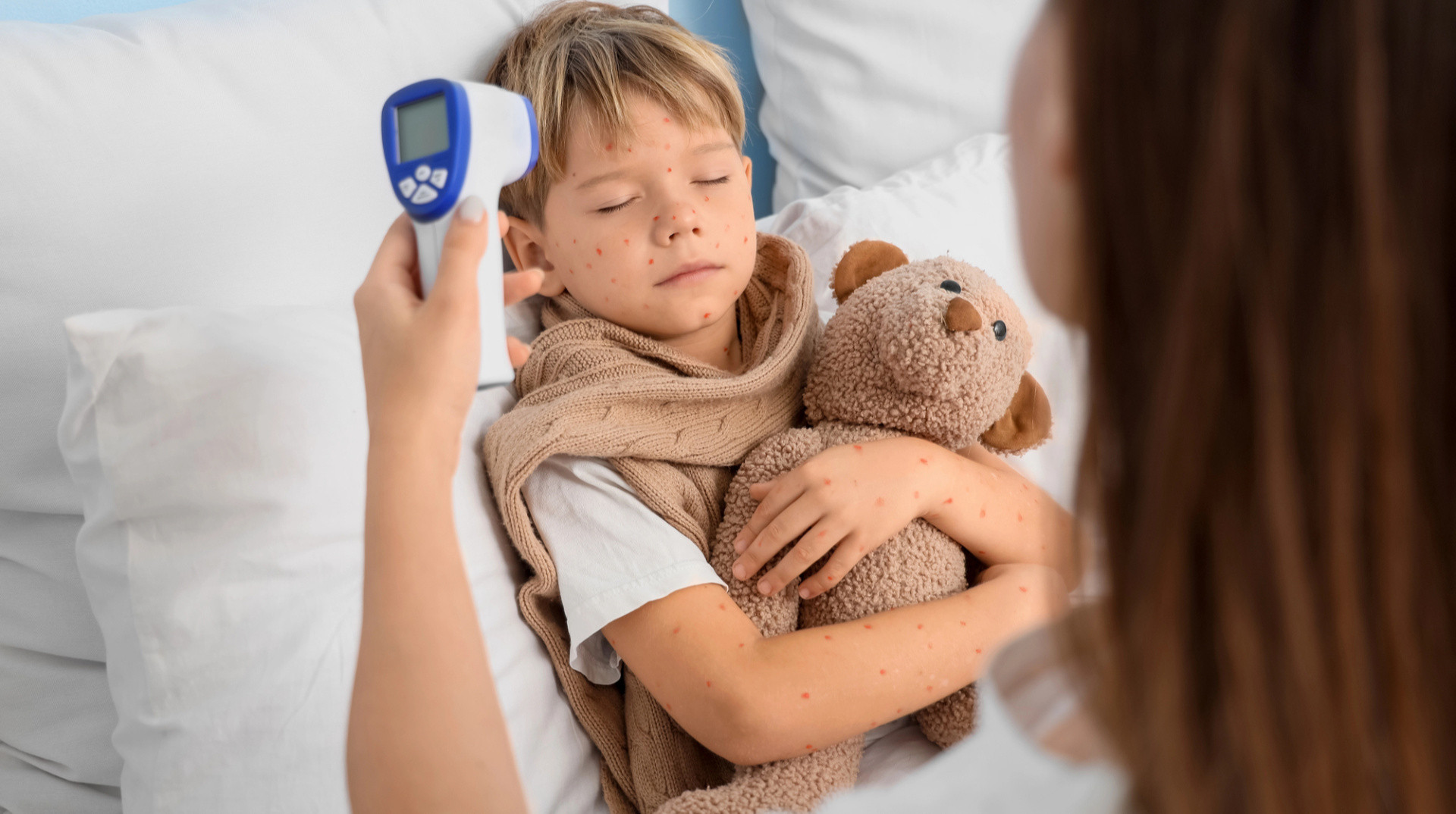 Перехворіти чи вакцинуватися: як захистити дитину від вітрянки