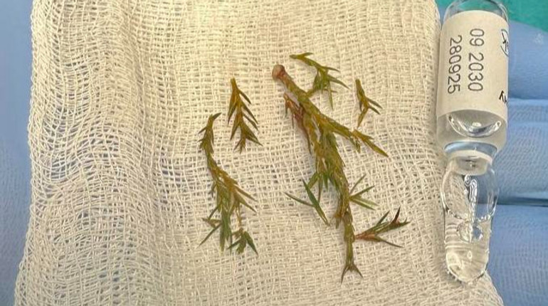 Наслідки могли бути фатальними: у Львові врятували хлопчика, який мало не задихнувся від гілок ялинки