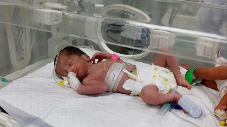 У Секторі Гази врятували немовля з утроби матері, яка загинула внаслідок обстрілу