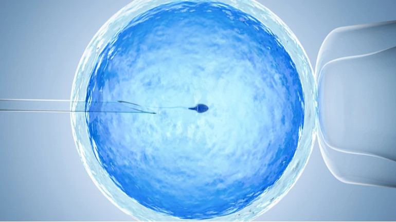 Anti -demographic: Doctors have criticized the Government's draft on reproductive technologies