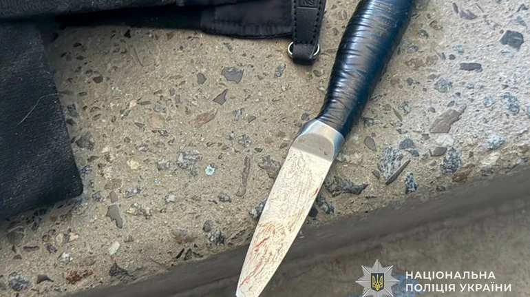 Уламок ножа залишився в голові: у Тернополі школярка напала на однокласницю