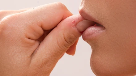 Гризете нігті чи кусаєте губи? Що ховається за нервовою звичкою і як це припинити – пояснюють медики