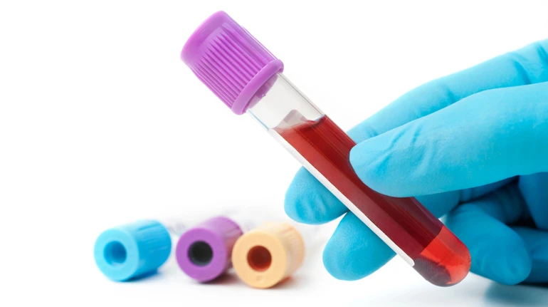 Експерти FDA підтримали аналіз крові на 50 видів раку, хоча його ефективність досі викликає сумніви