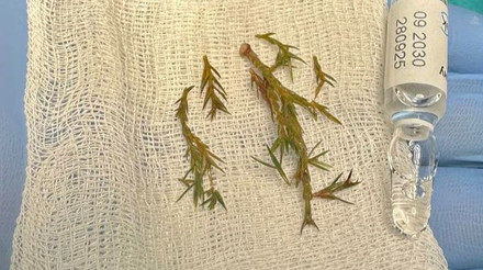 Наслідки могли бути фатальними: у Львові врятували хлопчика, який мало не задихнувся від гілок ялинки