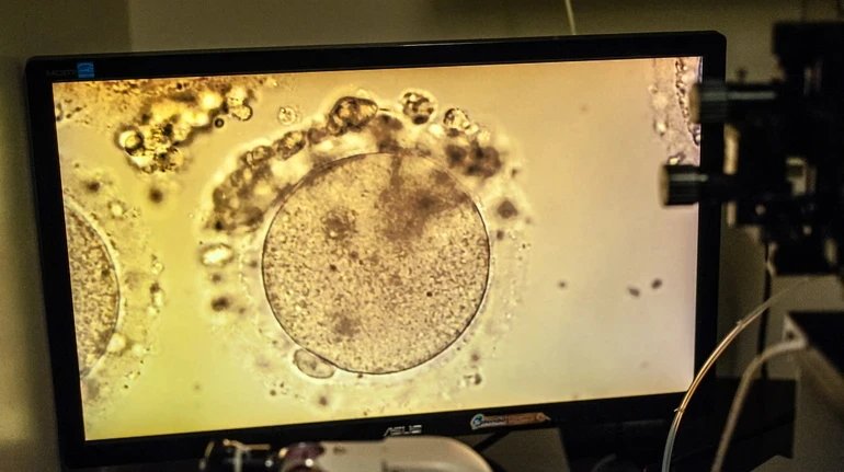 Чи можна покращити якість яйцеклітин, коли хочете зачати дитину – відповідає ембріологиня