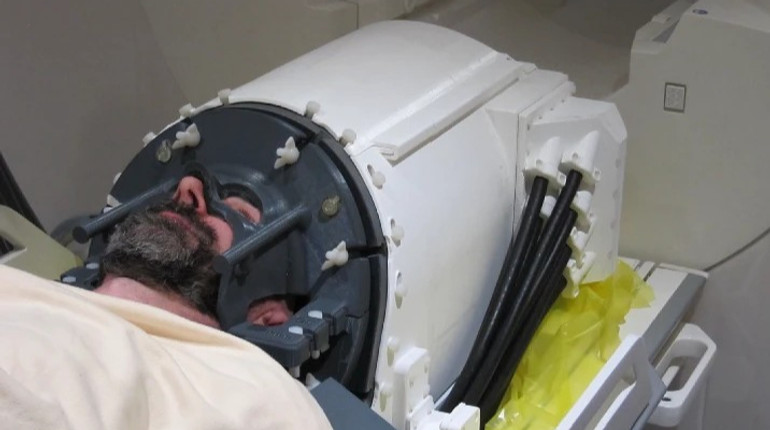 Вчені створили ультразвуковий шолом для лікування неврологічних хвороб без хірургічних втручань