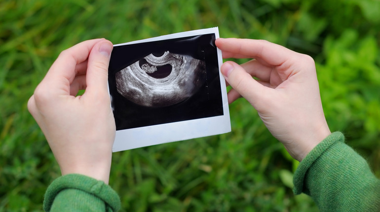 В Алабамі суд визнав ембріони людьми: лікарі кажуть, це не має наукового підґрунтя