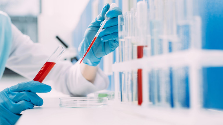 Diagnosis of rare genetic diseases: created a new analysis