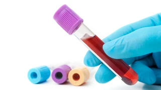 Експерти FDA підтримали аналіз крові на 50 видів раку, хоча його ефективність досі викликає сумніви