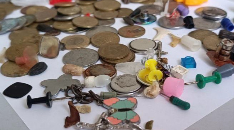 Від молочних зубів до канцелярських цвяхів: лікарі розповіли, що діти найчастіше вдихають та ковтають