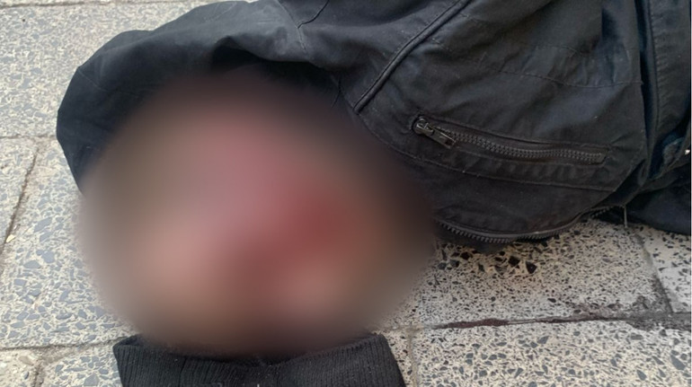 У Львові чоловік напав з бритвою на студентку: його покарають за хуліганство