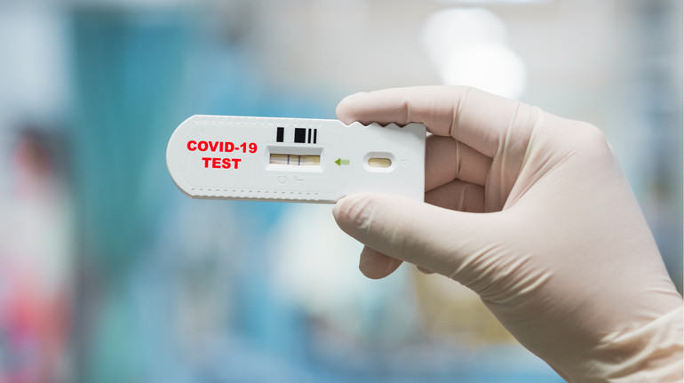 МОЗ: У серпні в Україні зафіксували понад 26 тисяч випадків COVID-19