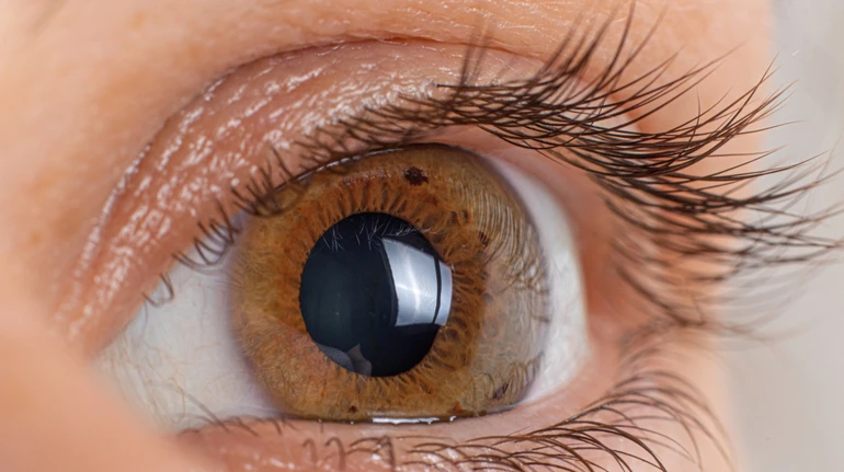 В Іспанії з луски риб створили штучну рогівку ока: вона може стати альтернативою донорської