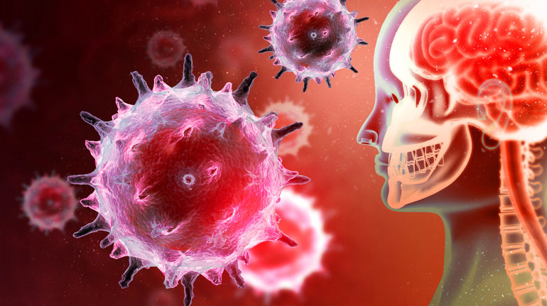 Туберкульозний менінгіт: як розпізнати та правильно лікувати смертельно небезпечну хворобу