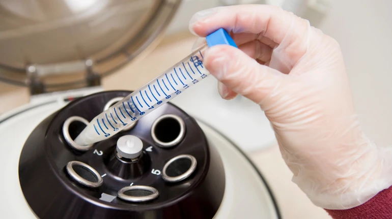 Кількість не означає якість: учені з’ясували, як утримання від сексу впливає на чоловічу фертильність