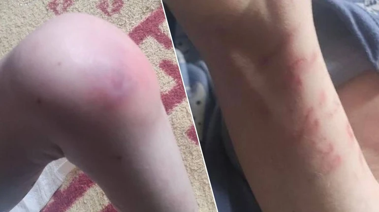 Недоїдання, проблеми з розвитком й антисанітарія: у Білій Церкві з родини вилучили трьох дітей