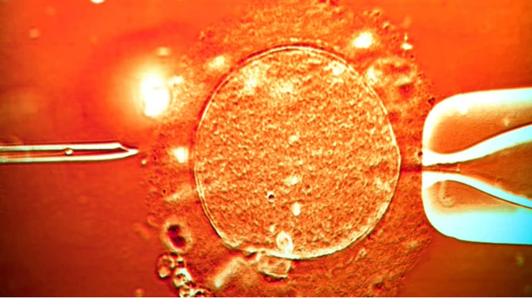 У Європі донор сперми з мутацією став батьком сотень дітей: постраждалих побільшало