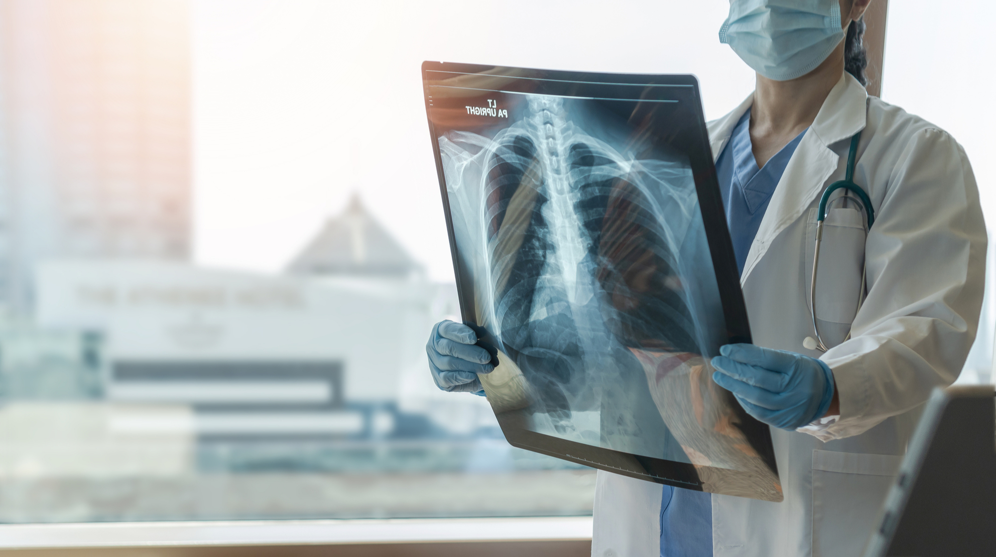 In 2023, 20,000 new cases of tuberculosis were detected in Ukraine