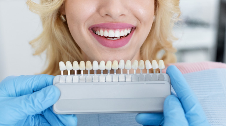 Відбілювання зубів вдома: які засоби існують та як вони діють