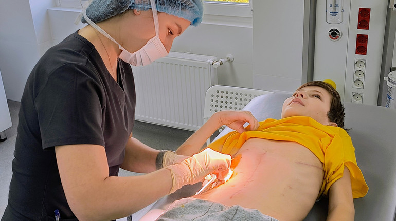 Удар об кермо спричинив глибокий розрив печінки: лікарі врятували хлопчика, який впав з велосипеда