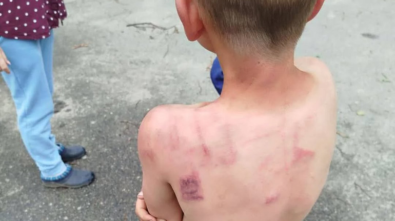 Поліцію Житомирщини звинуватили у бездіяльності щодо батька, який б'є дітей: що відомо про ситуацію