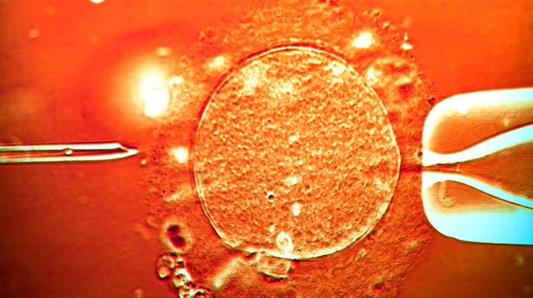 In Europe, 67 children were embarked from a donor with a cancer mutation