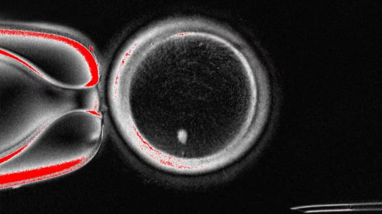 Scientists have found a method of creating eggs from skin cells: Can healthy children be born