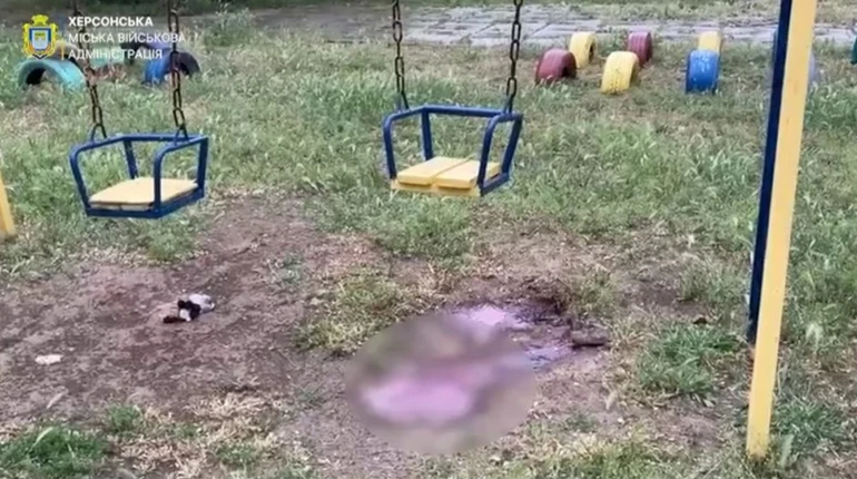 Атака на дитячий майданчик у Херсоні: 3-річна дівчинка та її мати у важкому стані