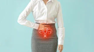 Хвороба, яку не діагностують роками. Що таке ендометріоз та як він впливає на шанси завагітніти?