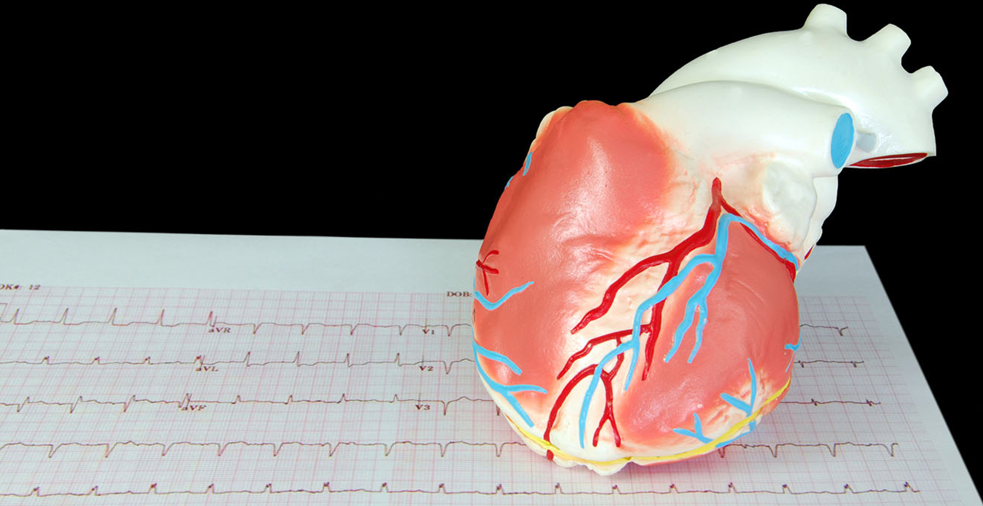 Інфаркт: 5 фактів про найпоширенішу хворобу серця