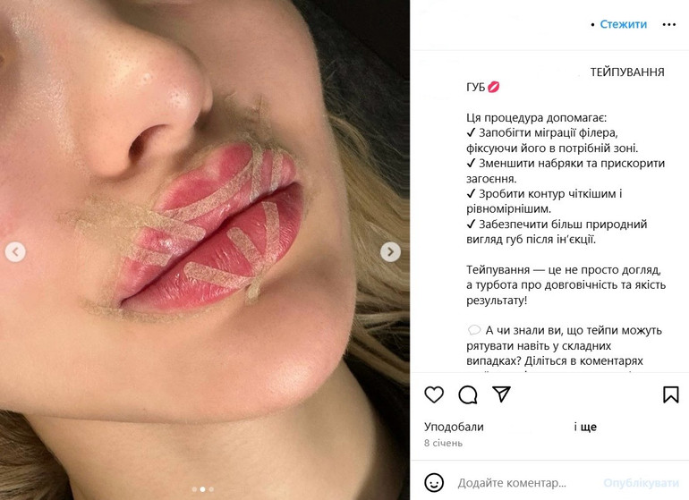 Тейпи для губ