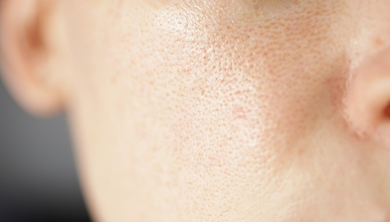 Care for baby and teenage skin: features and stages