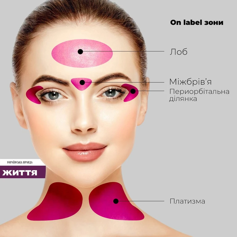 On label зони для ботоксу