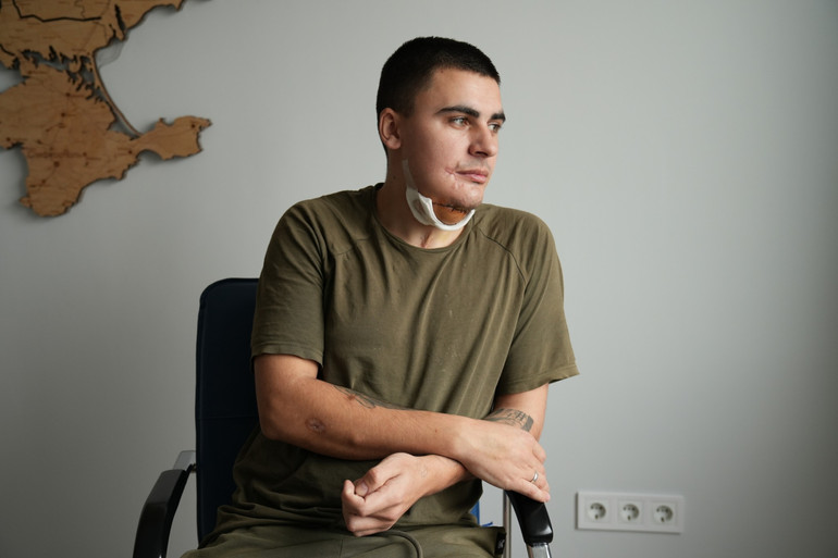 Defender Andriy, who underwent reconstructive surgery