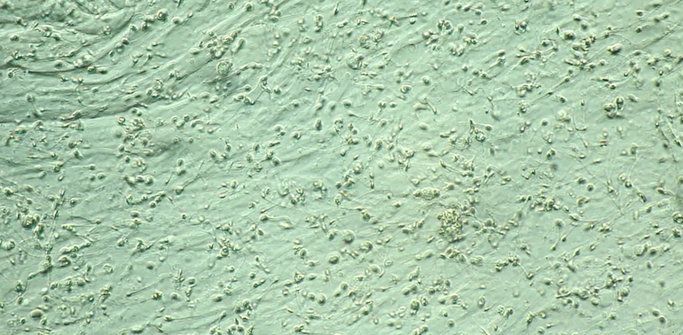 Сперматозоїди