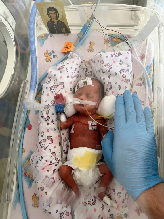 У Львові виходили немовля, яке народилося на 25-му тижні з вагою 750 грамів