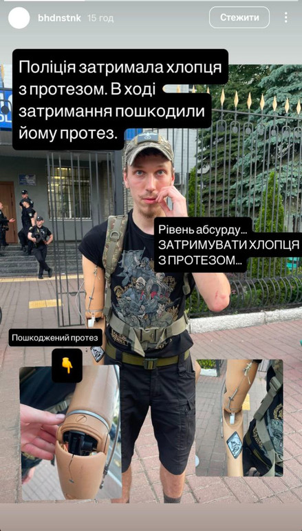 У соцмережах писали, що поліція зламала військовому протез