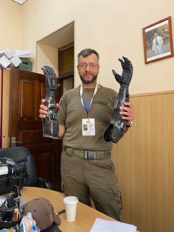 Остеоінтеграція не фінансується державою, а тому в місяць тут можуть робити одну-дві таких операції.