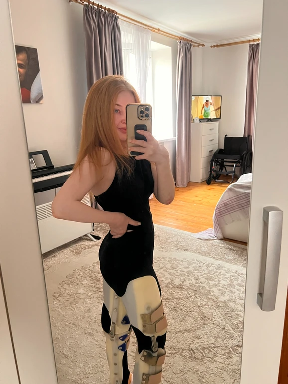 жінка в ортезах