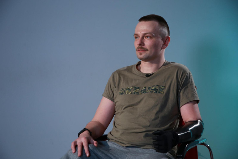 “Techiya Foundation” NGO of Oleg Krot provided a soldier with prosthetic limbs – News
